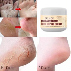 Eelhoe Foot Repair Cream