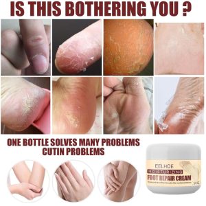 Eelhoe Foot Repair Cream